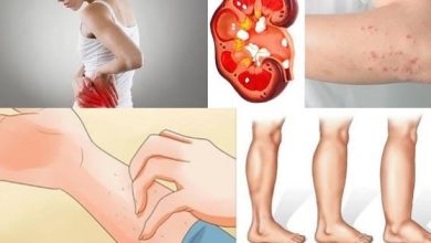 Signs that Your Kidneys May be in Danger